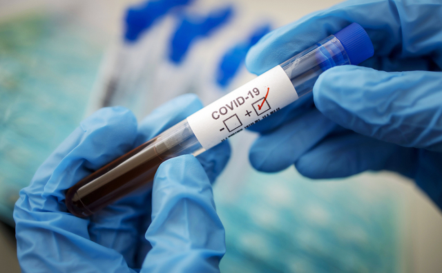 В Рузском округе получено 280 отрицательных тестов на коронавирус